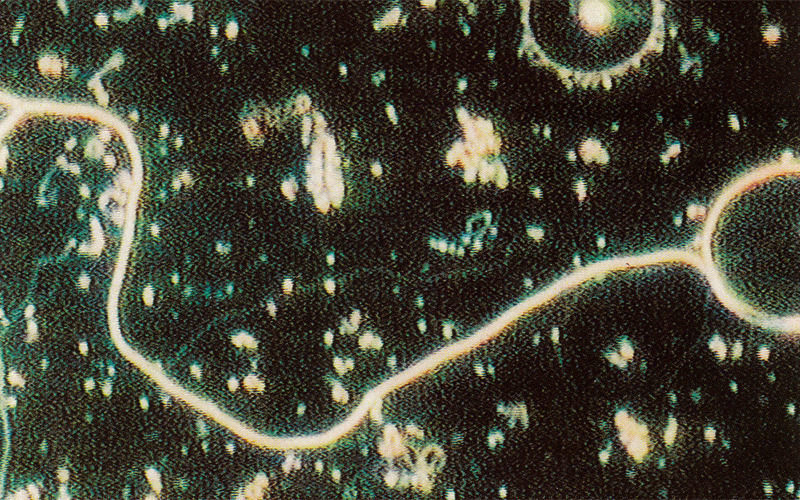 Makrochondritauswuchs aus Erythrozyt mit Symprotitkopf