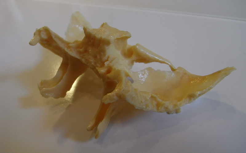 Das Keilbein (Sphenoid), ein Knochen von ganz zentraler Bedeutung bei der craniosacralen Therapie